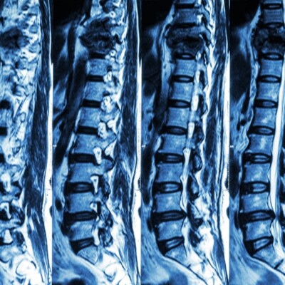 X-ray of the spine