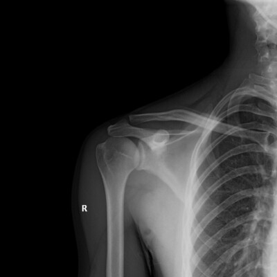 shoulder x ray positions