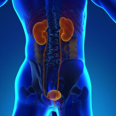 X-ray Kidney, Ureter, and Bladder